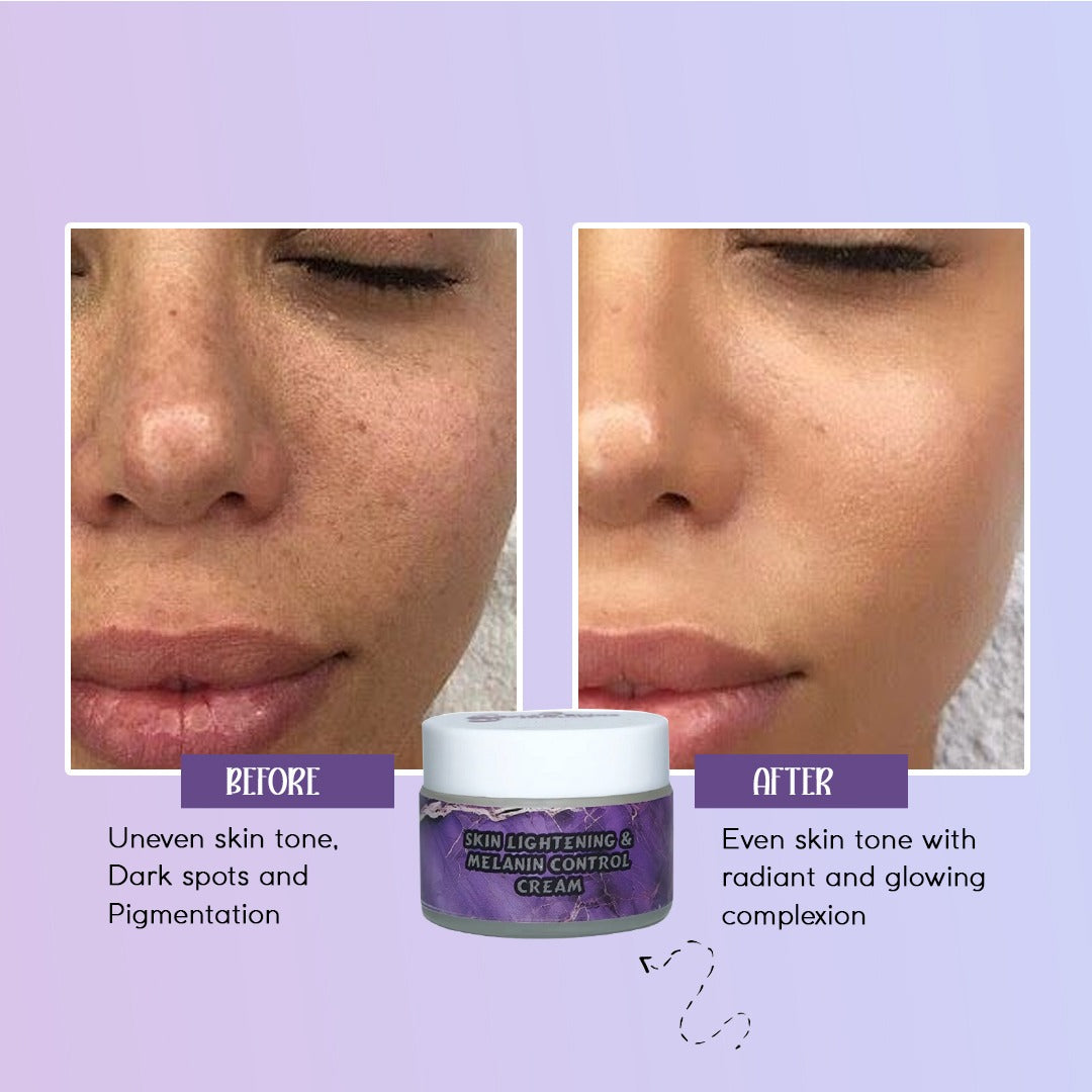 Skin Lightening & Melanin Control Cream